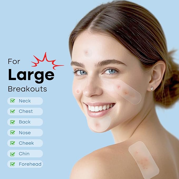 Large Pimple Patches Full Face,484 Patches,XL Acne Patches,Big Hydrocolloid Bandages for Body, Forehead, Chin, Neck Zit Breakouts w/Tea Tree, Salicylic Acid & Cica Oil|,Freely Customized Pimple Patch