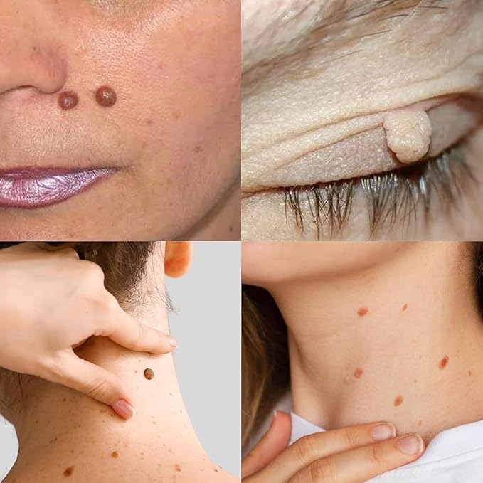 Gaukomzs 2-Pack Bee Venom Cream, New Professional Bee Venom Repair Cream, Natural Skin Moisturizer For All Skin Types