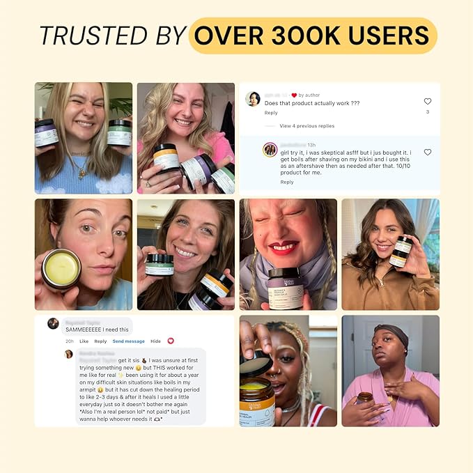 Universal Flare Care | Essential Oil Free | Relief for Rashes, Eczema, Psoriasis, Hidradenitis Suppurativa, Impetigo, Dermatitis, Wound Care, Sensitive Skin w/ Propolis & Egg Yolk 2 oz