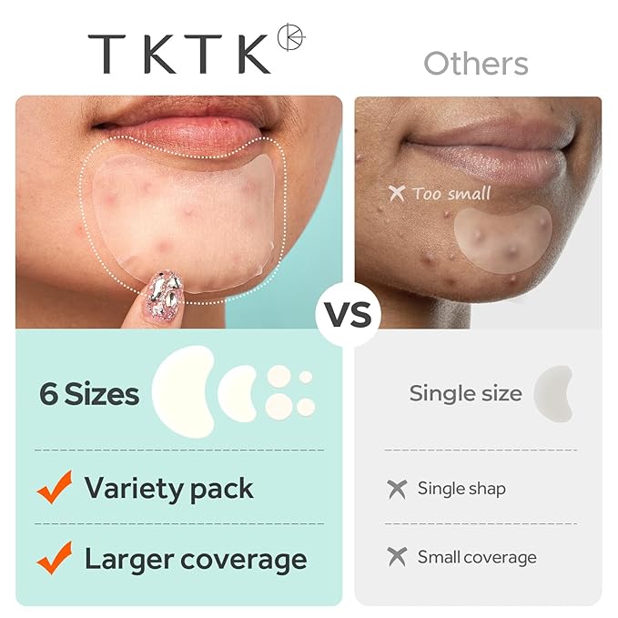 TKTK Chin Pimple Patches (235 Count 6 Sizes), XL Contoured Hydrocolloid Chin Patch 62x42 mm, Large Acne Patch for Face Blemishes Zit Breakouts, Maximum Absorption Overnight Stickers