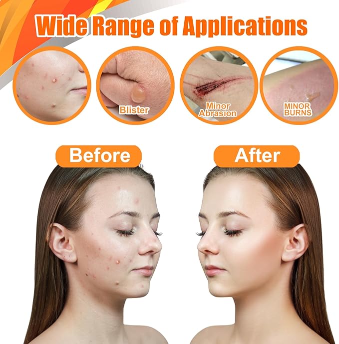 Hydrocolloid Roll for Wound Care – 2 in × 16 ft | Cut-to-Size Bandages, Patches & Tape | Flexible Hydrocolloid Patch, Waterproof & Skin-Safe Adhesive for Daily Use