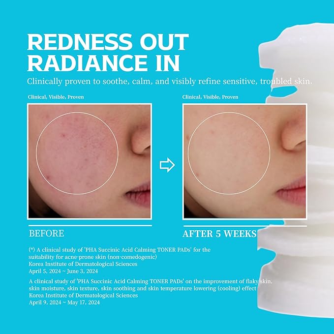 Re.SPN PHA Succinic Acid Calming Toner Pads – Daily Exfoliating, Hydrating and Soothing with CICA, Caffeine, Non-comedogenic, Vegan, Glass Skin, K-Beauty (70 Count)