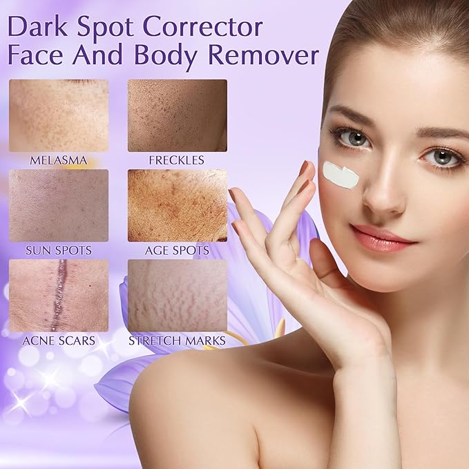 Dark Spot Remover for Face, Dark Spot Corrector Cream, Rapid Tone Repair Upgraded Formula Retinol Serum for Sun Spots, Age Spots, Skin Brown, Melasma Skin Care with Vitamin C for Women 1.7 Fl OZ