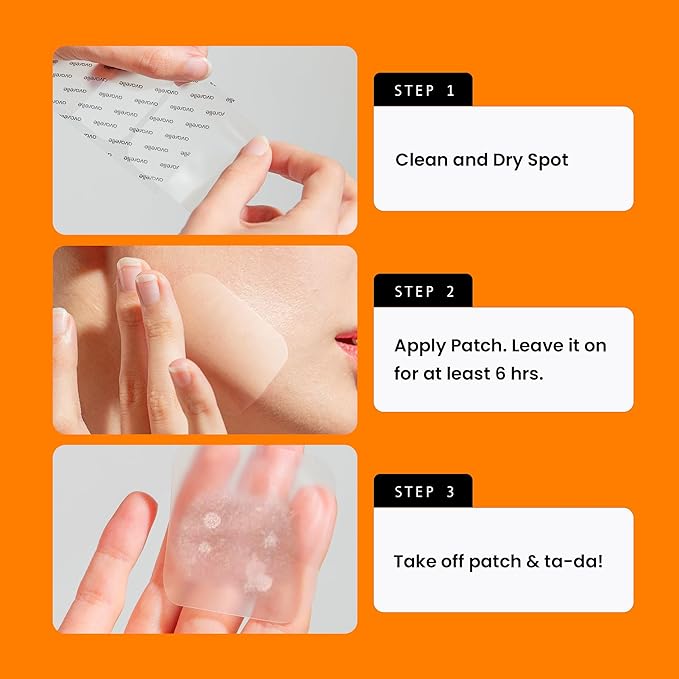 AVARELLE Acne Patches XL, Acne Cover Patch Large | Pimple Patches for Face Cheek & Nose (8 Count) | Large Hydrocolloid Acne Treatment with Tea Tree, Calendula, & Cica