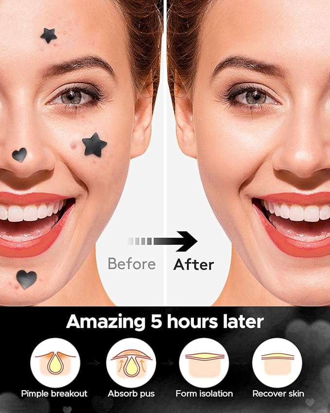 LitBear Acne Patch Pimple Patch, Black Star & Heart Shaped Acne Absorbing Cover Patch, Hydrocolloid Acne Patches For Face Zit Patch Pimple Sticker Acne Dots, Tea Tree Oil + Centella (108 Count)