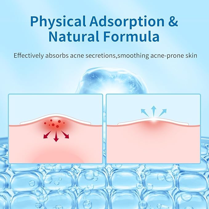 180 Counts Original Pimple Patches for Face, Hydrocolloid Acne Pimple Patch with Tea Tree Oil for Party Gift Covering Zits Blemishes