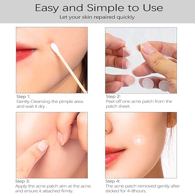 Acne Pimple Patches Invisible for Face Forehead, 12mm/9mm Hydrocolloid Acne Patches Stickers with Tea Tree Oil to Fast Relieve Zits, Acnes (5 Sheets/180 Patches)