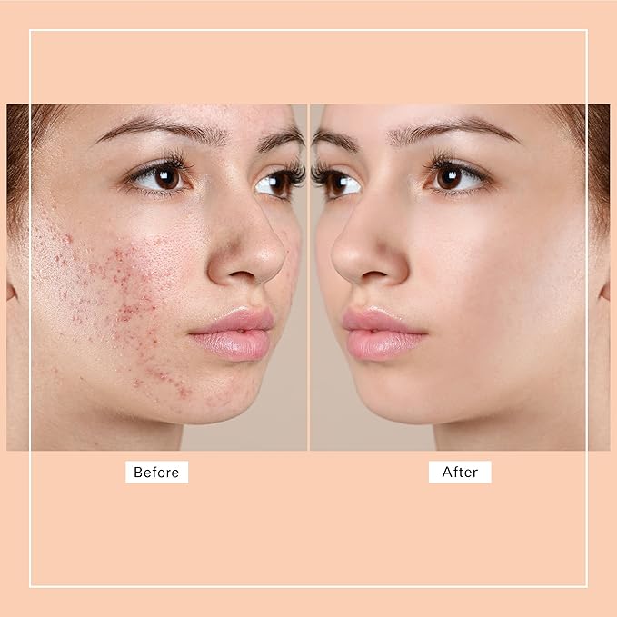 Purifying Toleriane Foaming Facial Wash Cleanser - Oil Free Face Wash for Women & Men with Hyaluronic Acid + Ceramides, Pore Cleanser Safe for Sensitive Skin, Won't Dry Out Skin, Soap Free 3.38 fl. OZ