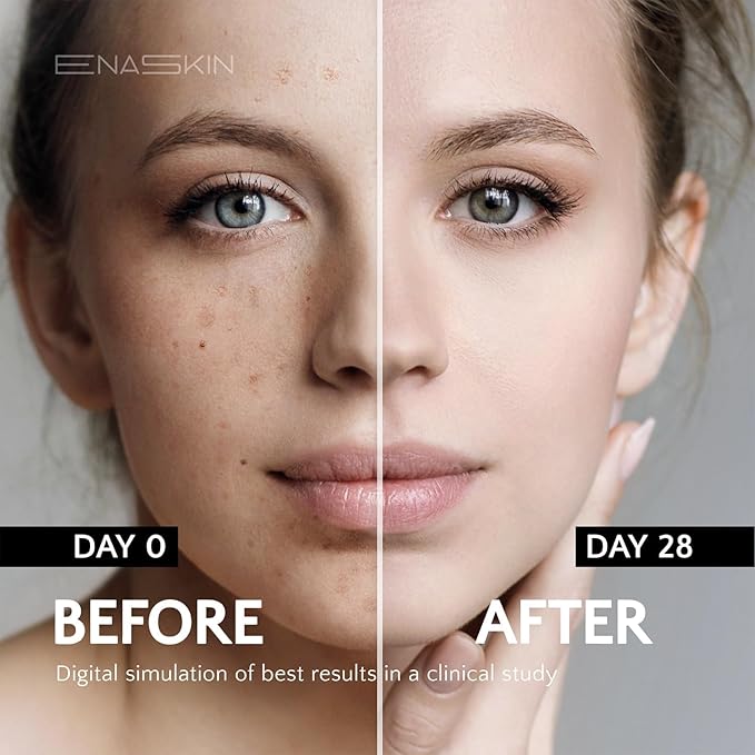 EnaSkin Dark Spot Remover Face & Body Serum: Age Spot Sun Spot Freckles Melasma Brown Spot - Advanced Formula with Niacinamide for Women and Men 1.0 Fl Oz (Pack of 2)