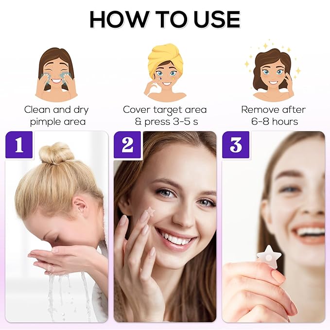 Star Pimple Patches 360 Counts, Hydrocolloid Pimples, w/Salicylic Acid & Tea Tree Oil, Pimple Patches for Face - Conceal Whiteheads, Blackheads And Blemishes, Ance (10mm,12mm,14mm)