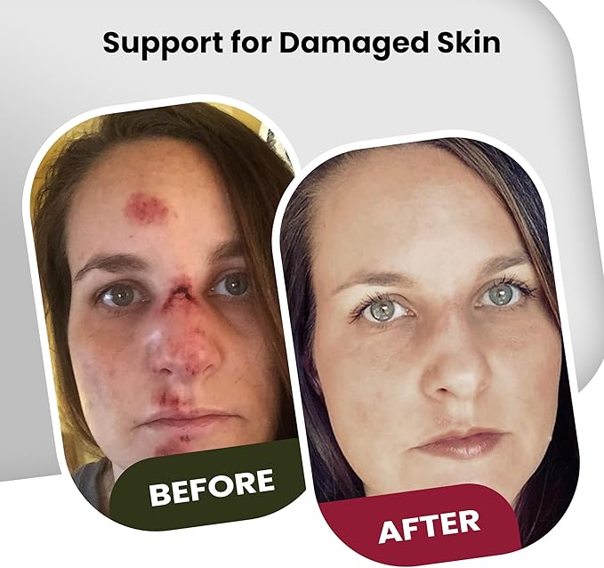 Brave Soldier Antiseptic Healing Ointment - Best Wound Care & Skin Repair Cream with Tea Tree Oil - First Aid Supplies for Burns, Wounds & More, 1 Ounce