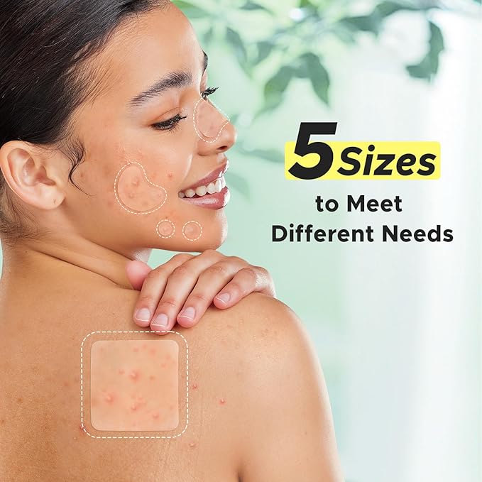 LitBear Pimple Patches for Face, Large Acne Patch, XL Hydrocolloid Bandages,Zit Stickers for Forehead, Chin, Nose, Body, Back, and Chest, Includes Crescent, Square, and Dot (5 Sizes, 507 Patches)