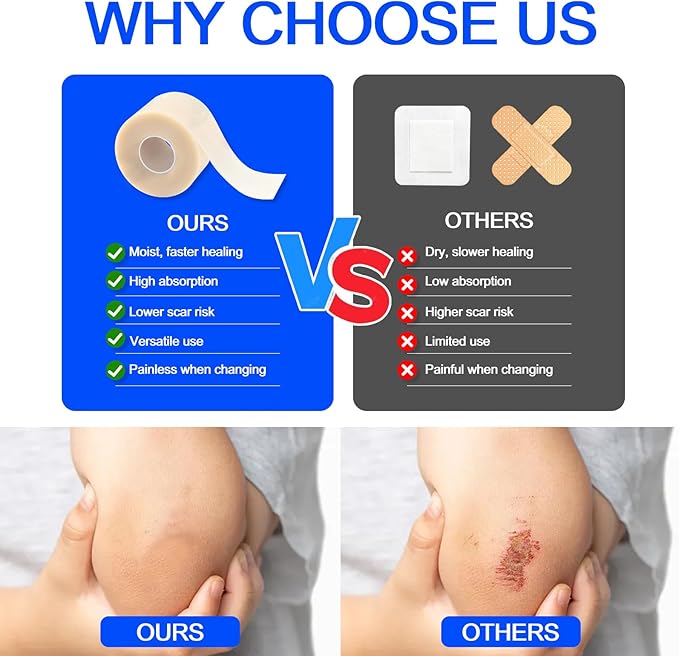 Hydrocolloid Bandages Roll 2" × 19.7' – Hydrocolloid Roll for Wound Care, Hydrocolloid Patch Large, Hydrocolloid Gel Bandages Hydrocolloid Dressing with Self-Adhesive, DIY Size Shape First Aid Kit