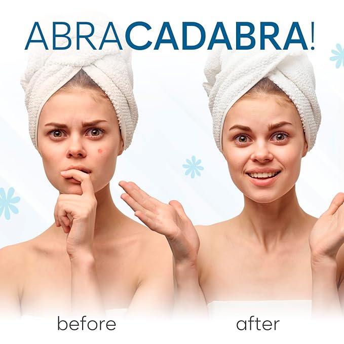 Invisible Pimple Patches for Face (324 Count), Zit Patches for Blemishes, Hydrocolloid Bandages, Zit Stickers for Face - S/L Sizes