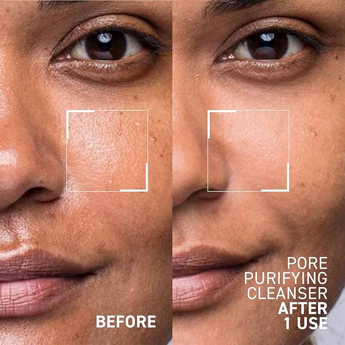 Dr. Brandt Pores No More, Pore Purifying Cleanser - Non-Drying Gel - Helps to Minimize the Appearance of Pores & Dissolves Impurities - 3.5 fl oz