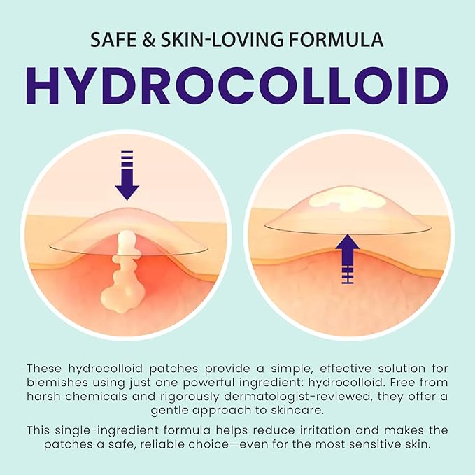 Pimple Patches for face and body | 36 Count (12mm), Invisible Hydrocolloid Acne patches – Face Stickers for Zits, dark spot , Blemishes, Pore strips, Forehead pimple patch , Invisible spot cover