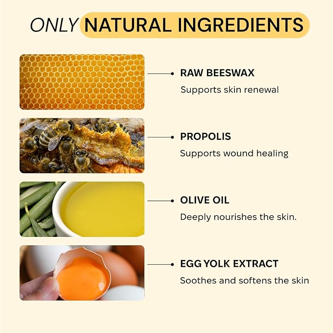 Universal Flare Care | Essential Oil Free | Relief for Rashes, Eczema, Psoriasis, Hidradenitis Suppurativa, Impetigo, Dermatitis, Wound Care, Sensitive Skin w/Propolis & Egg Yolk 1 oz