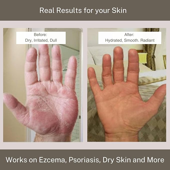 InfiniteAloe Complete Skin Care, Aloe Vera Powered Face and Body Cream for All Skin Types, Dry Skin Everyday Hero, Original Scent - Large Jar 8 oz