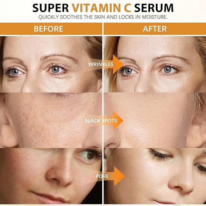 Super Vitamin C Serum for Women Over 70: Advanced Anti-Aging Vitamin C, Niacinamide, Vitamin E & Caffeine Formula,Hydrates, Firms, Lifts, Targets Wrinkles & Dark Spots, 1.0 fl. oz.