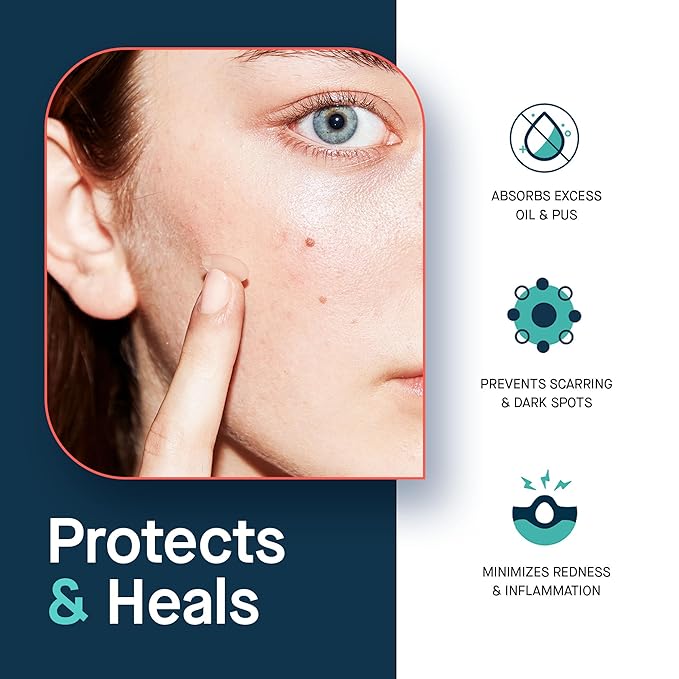 SLMD by Dr. Pimple Popper Salicylic Acid Pimple Patches - Treat Acne and Improve the Appearance of Dark Spots - Thin Transparent Patches with Salicylic Acid - 2 Sizes (24 count)