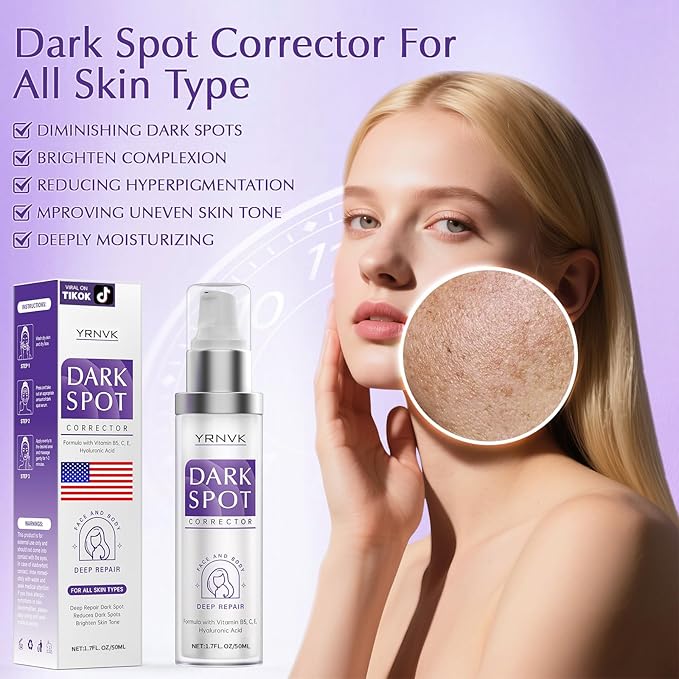 Dark Spot Remover for Face, Dark Spot Corrector Cream, Rapid Tone Repair Upgraded Formula Retinol Serum for Sun Spots, Age Spots, Skin Brown, Melasma Skin Care with Vitamin C for Women 1.7 Fl OZ