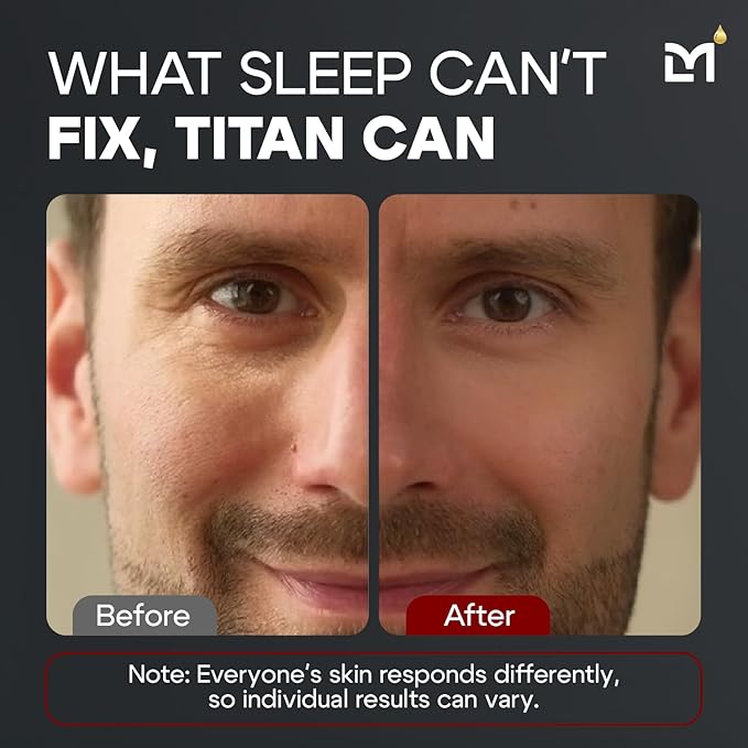 Titan Anti-Aging Mens Eye Cream - Dark Circles Under Eyes Treatment - Eye Bags Treatment for Men - Puffy Eyes Treatments for Men - Peptides, HA, Herbal Extracts - All Skin Types - Unscented
