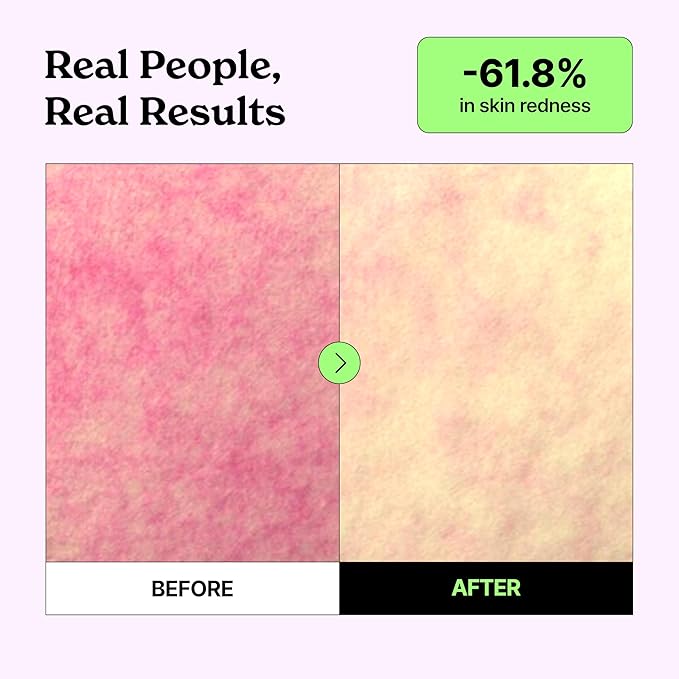 Black Olive PDRN™ Repairing Marble Gel Mask (4EA) | Real Hydrogel Korean Face Masks with Skin Barrier Repair Cream & Serum | Deep Hydration with Ceramides, Redness Relief, 24-Hour Radiance