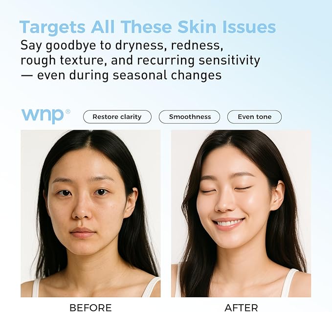 WNP Hyaluronic Acid Hydrating&Soothing Toner: 4D Hyaluronic Acid,Red Algae Extract,Bifida Ferment Lysate, Panthenol Deep Moisture&Skin Barrier Repair Vegan Skincare for Dry & Sensitive Skin