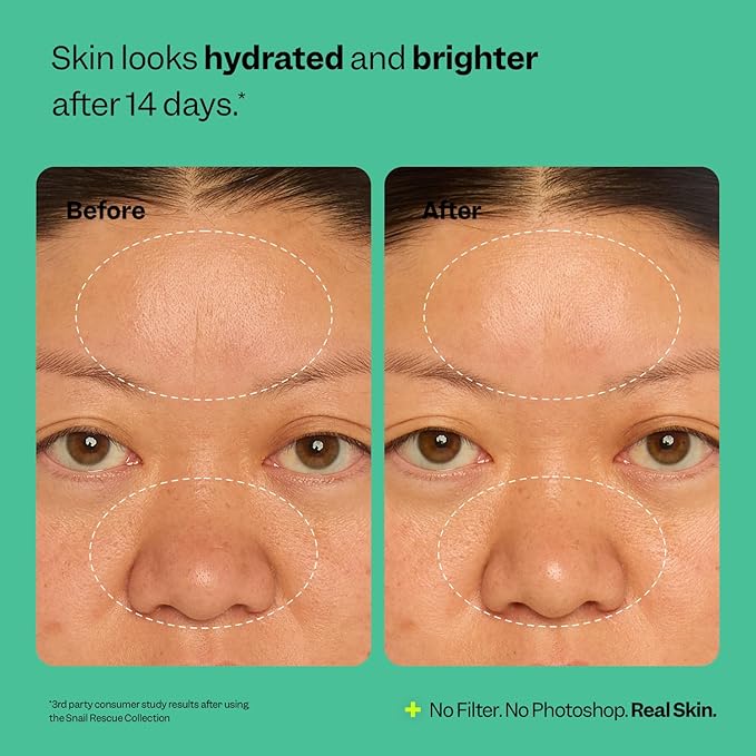 Peach Slices | Snail Rescue All-in-One Oil Free Face Moisturizer | 95% Snail Mucin | Lightweight, Long-Lasting Hydration | Silicone-Free | Face Cream | Skin Care | Clean & Cruelty-Free | 2.82 oz