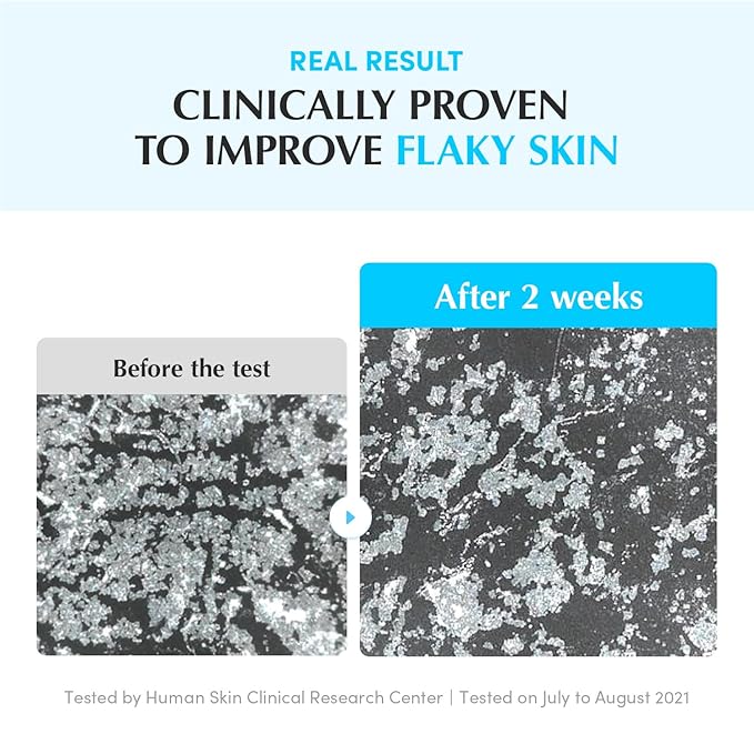 Swimming Pool Toner - Korean Toner for Daily Exfoliating & Deep Hydration with Natural Enzyme Protease & Hyaluronic Acid, For Sensitive Skin, 10.14 Fl Oz (300ml)