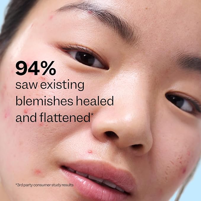 Peach Slices | Acne Exfoliating Toner | 2% Salicylic Acid | AHA+BHA Exfoliation | Facial Cleanser | Calms & Soothes | Prevents Breakouts | Alcohol & Sulfate Free | Skin Care for Women & Men | 4 Oz