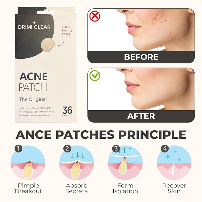 Drimiclear™ - #1 Hydrocolloid Acne Pimple Patch for Covering Zits and Blemishes in Face and Skin, Vegan-friendly and Not Tested on Animals (36 Count)
