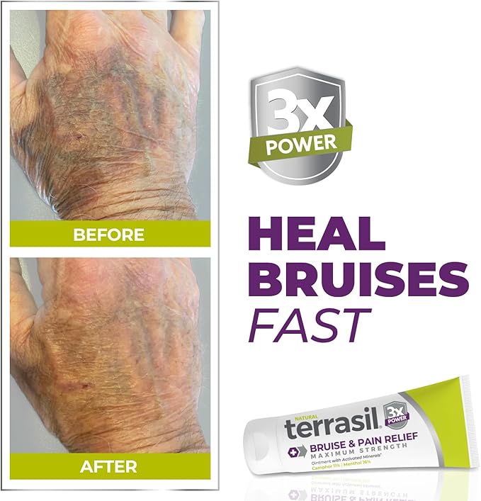 terrasil Bruise Cream for Thin Skin Bruises, Senile Purpura Treatment, Fast Healing of Discoloration, Swelling with Arnica Extract and Natural Ingredients for Elderly Skin Bruising, 1.7 Oz