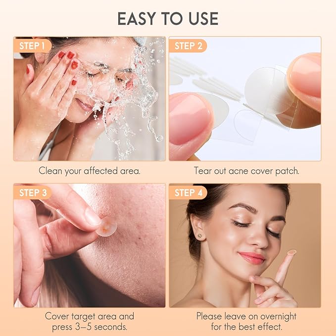 Acne hydrocolloid Patches, 5 sizes and 4 shapes with 186pcs, The innovative size L suitable face, body, nose, Pimple, Acne blemishes, with Salicylic Acid, Tea Tree Oil,Centella Asiatica