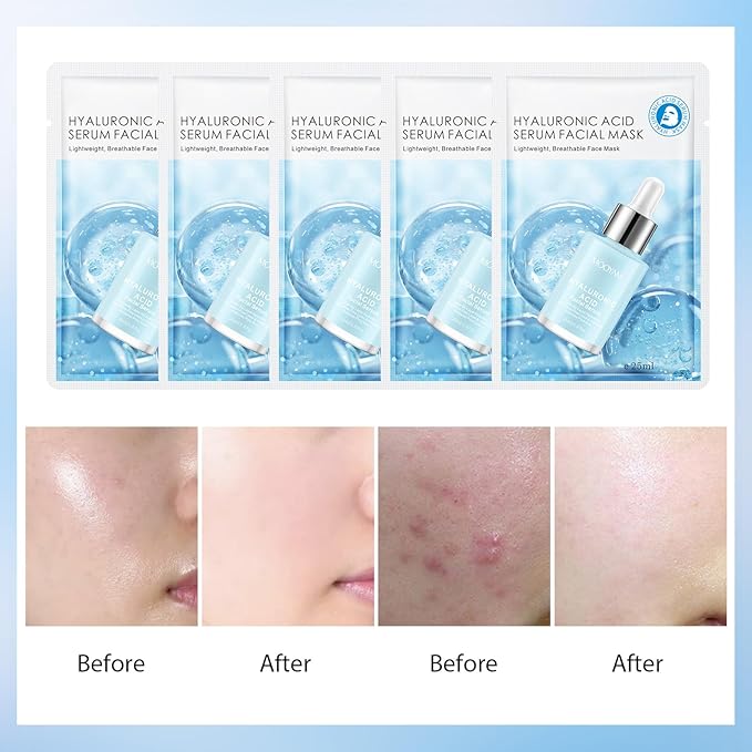 Facial Masks Skincare for Women,Salicylic Acid Moisturize Face Mask Sheet for Girl,Hydrating Face Mask for All Skin Types,Dry Skin & Sensitive Skin(10-Packs)