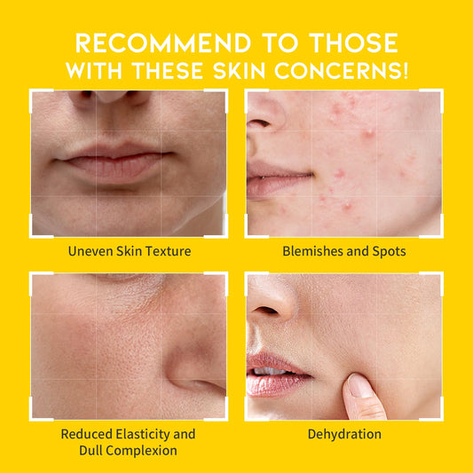 Boosting Toner Pads for Face Oily Skin Korean, #OOTD Vitamin C Niacinamide Heartleaf Hydrating Calming Redness, Vitamin C Toner Pad 70Pads 4.05oz 120ml