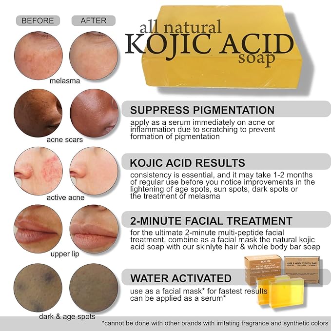 Kojic Acid Soap Natural -Fragrance Free and Dye Free- Dark Spot Remover Hyperpigmentation Corrector K-Beauty Formula - Turmeric, Glycerin, Collagen, Hyaluronic Acid, Retinol (2 Pack) 7oz.