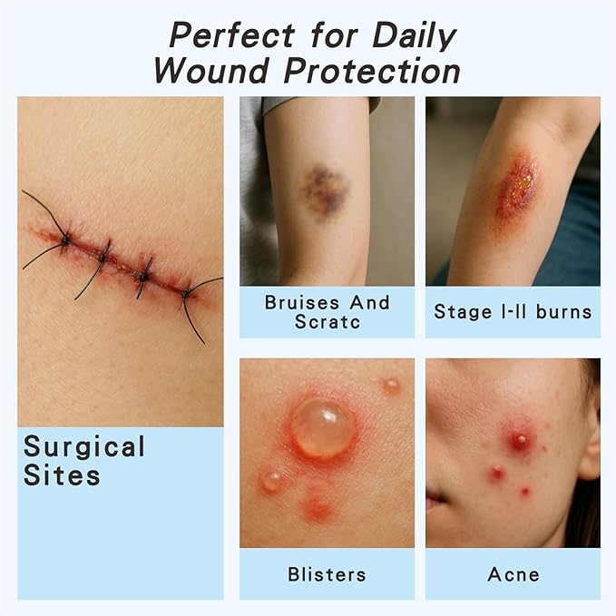 Hydrocolloid Healing Patches, 10 Count Premium 4"x4" Thin Adhesive Bandages for Blisters, Burns, Pressure Sores & Acne Treatment - Sterile Waterproof Cushioning with Extended Wear Technology