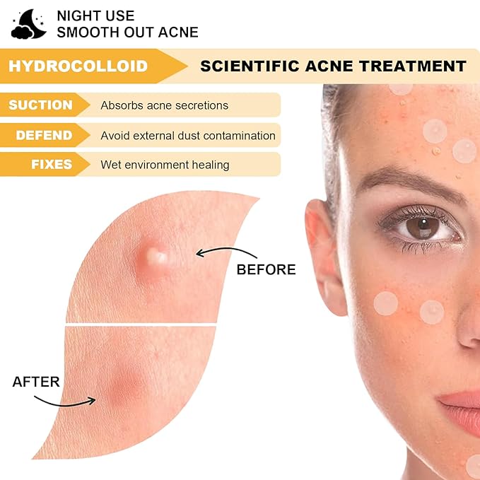 Pimple Patches for Face,Pimple Patch Pimple Stickers - Hydrocolloid Acne Patch for Covering Zits and Blemishes,Invisible Spot Rescue Pen-Quickly Covering and Shrinking Acne