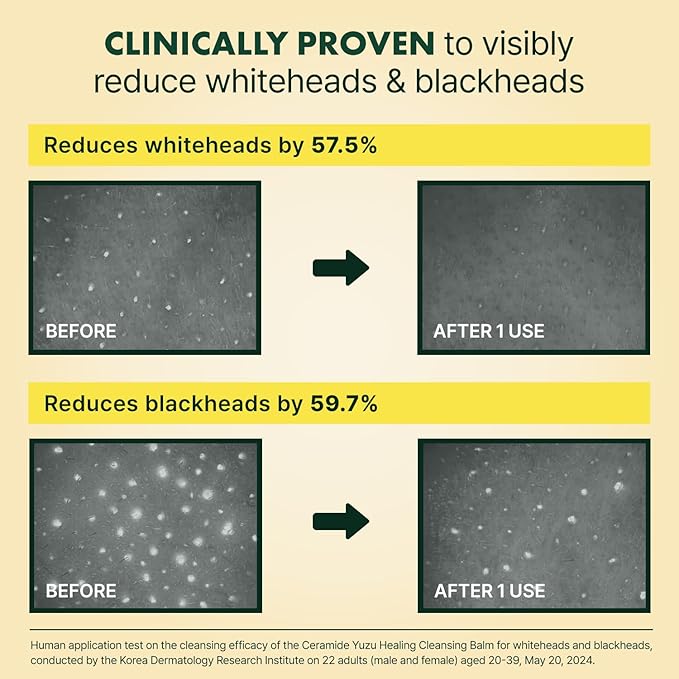 Ceramide Yuja Makeup Cleansing Balm with Travel Size | Deep Cleansing All-in-One Korean Face Cleanser, Makeup Remover, Zero Irritation, Blackheads Remover, Clean Beauty, Vegan (120g / 4.23oz)