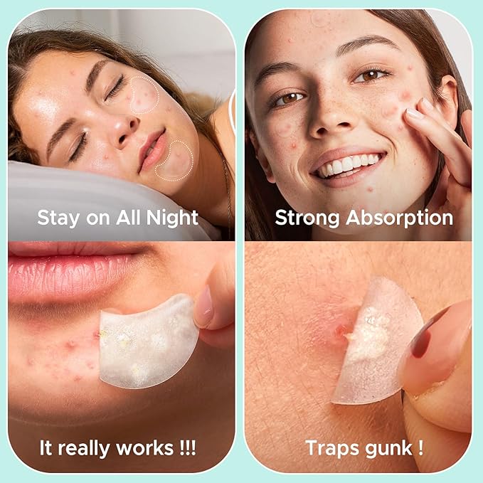 LitBear Pimple Patches for Face, Large Acne Patch, XL Hydrocolloid Bandages,Zit Stickers for Forehead, Chin, Nose, Body, Back, and Chest, Includes Crescent, Square, and Dot (5 Sizes, 507 Patches)