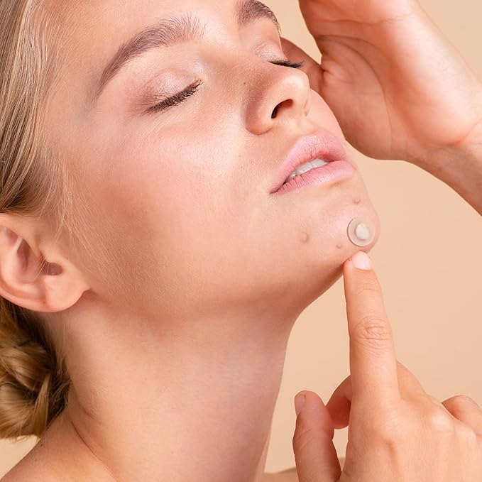 Pimple Patches for Face,Acne Patches for Face,Pimple Patch,Zit Patches,Hydrocolloid Blemish Patches for Covering Zits ,with Salicylic Acid,Tea Tree oil & Calendula oil (106 Counts, Count, 106.0)