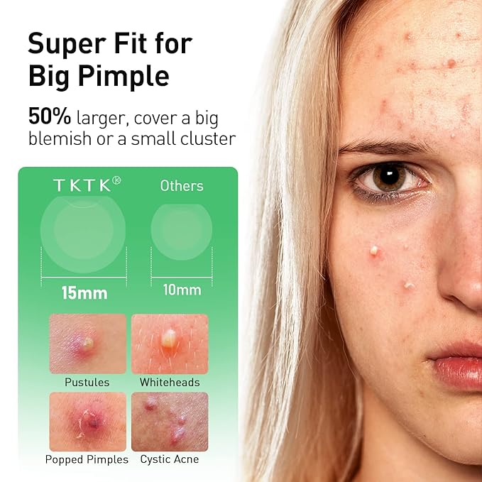 Pimple Patches, 15 mm Invisible Acne Patches for Face with Salicylic Acid, 0.01cm Extra Thin Outer Edge, Hydrocolloid Zit Patch for Pustule, Whitehead, Cystic Acne Spot, 48 Count
