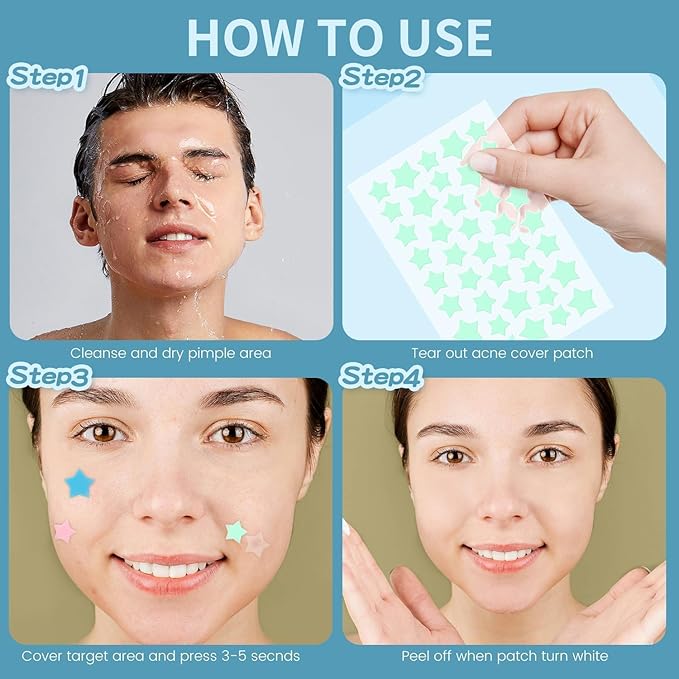 200 Counts Star Pimple Patches for Face, Hydrocolloid Acne Pimple Patches with Tea Tree Oil for Party Gift Covering Zits Blemishes