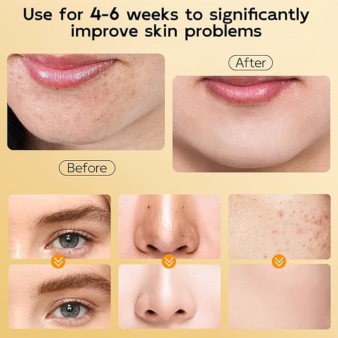 4 in 1 Bubble Turmeric & Kojic Acid for Face Cleanser - Turmeric Face Wash Foaming Cleanser - Exfoliation Deep Cleansing of Facial Skin - Suitable for Sensitive Skin - 3.38OZ