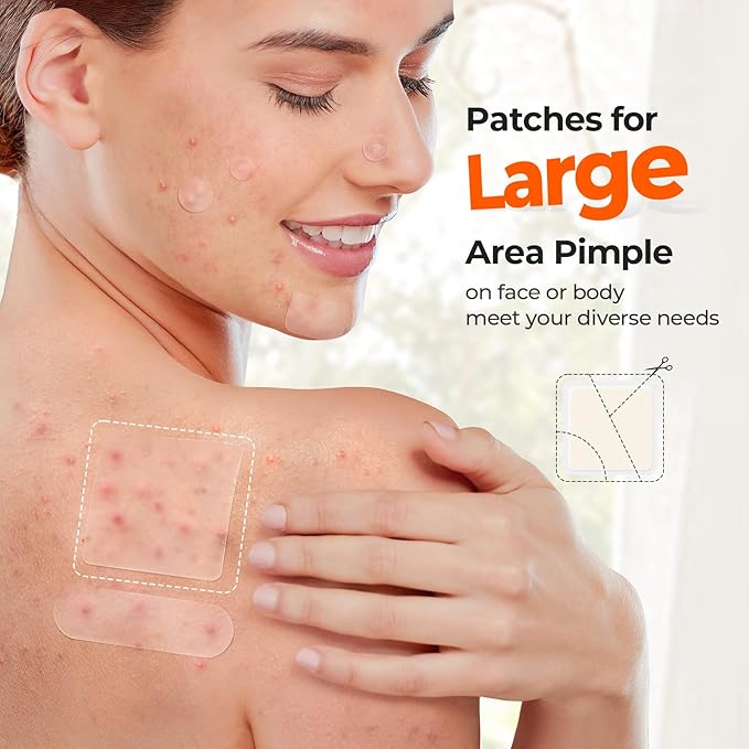 TKTK Hydrocolloid Bandages, 45 x 45 mm Large Pimple Patches for Face, XL Acne Patches for Body, Back, Forehead, Cheek Zit Breakouts, Big Hydrocolloid Patch (Square, Strip, Dot 5 Sizes 270 Count)