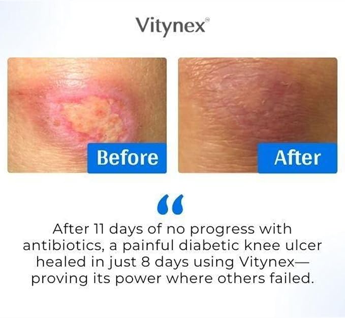 Skin Repair Wound Care Cream – 1 Oz Scar Prevention Cream First Aid Wound Ointment for Burns, Bites, Cuts, Ulcers, Abrasions – Deeply Nourishing Calendula Healing Ointment with Natural Ingredients