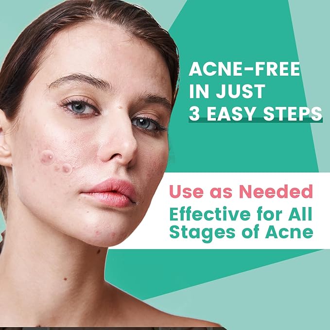 3-Step Microdart Pimple Patches Set – 83 Count, including 9 Microdarts Pimple Patches, 50 Pimple Poppers, and 24 Hydrocolloid Patches