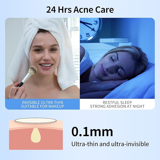 288 Counts Pimple Patches for Face, Hydrocolloid Acne Patches for Covering Zits and Blemishes, 2 Sizes of Ultra-Thin Spot Patch for All Skin Types