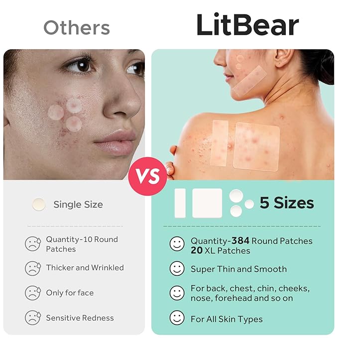 LitBear Large Pimple Patches, (5 Sizes 404 Counts) Big Acne Patches, Big Hydrocolloid Bandages for Body, Back, Face, and Chest, Zit Patches for Large Breakouts, Hydrocolloid Patch (XL Strip, Square)